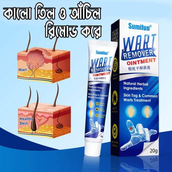 Orzinal New Wart Remover Ointment